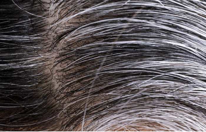 How To Remove White Hair Naturally?